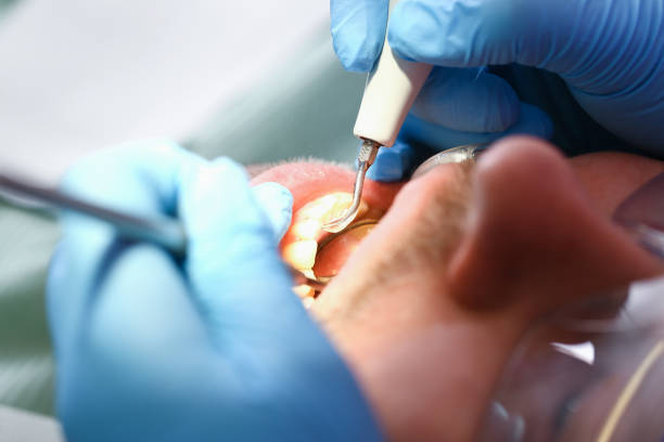 Best Emergency Tooth Extraction in South Greensburg, PA