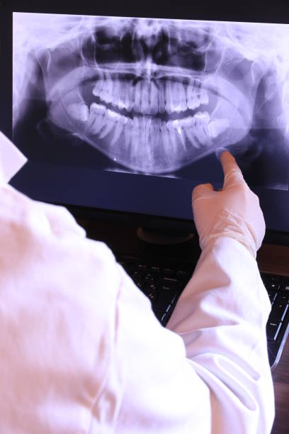 Best Emergency Treatment for Dental Infections or Abscesses in South Greensburg, PA
